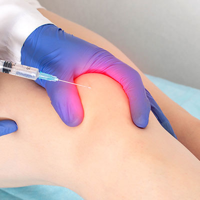 Hyaluronsäureinjektionen